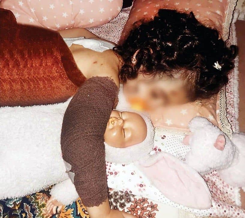 حمله سگ‌های ولگرد به دختربچه ۳ ساله در کرج