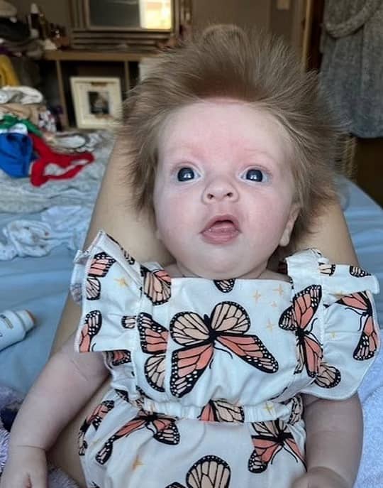 تصاویر/ موهای عجیب این نوزاد کل دنیا را حیرت زده کرد!