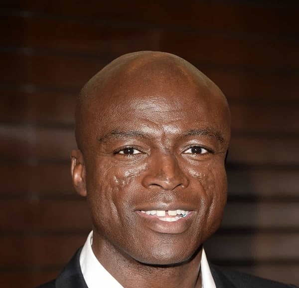 Seal؛ خواننده‌ای با یک عالمه زخم روی صورتش