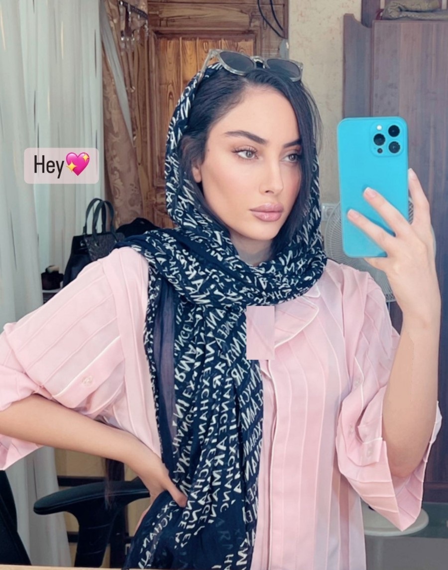 رونمایی "ترلان پروانه" از چهره عمل شده و مدلینگی جدیدش/ عکس