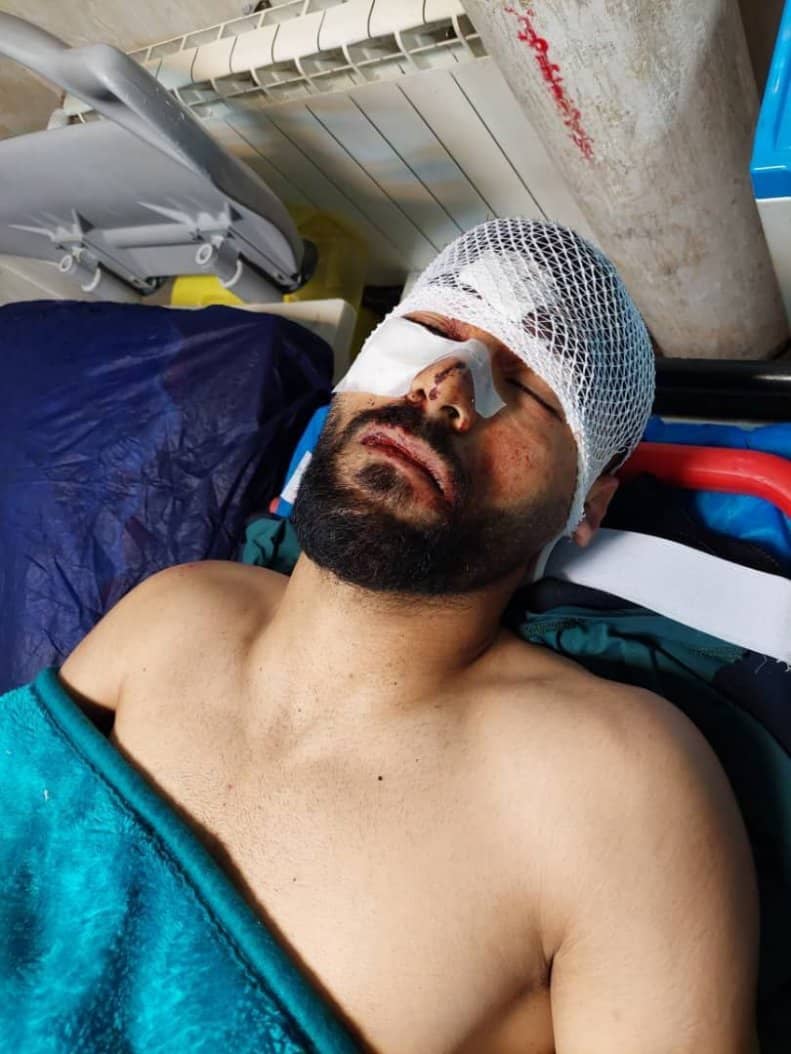 تصادف شدید سامان فلاح ستاره ملی‌پوش پیکان 