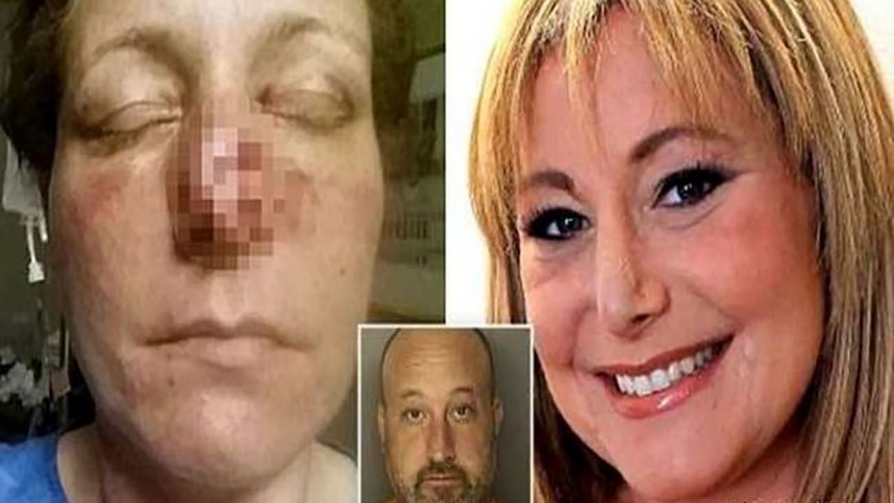 مرد روانی نوک بینی همسرش را کند