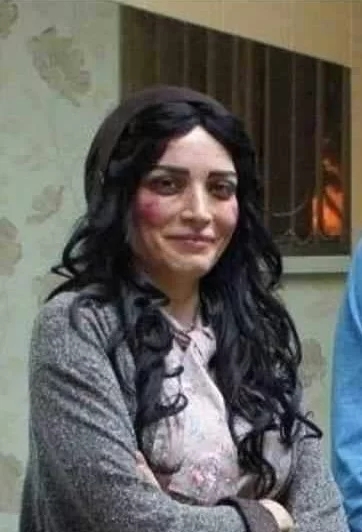 چهره “بهنوش طباطبایی” را این سر و وضع نخواهید شناخت/ عکس