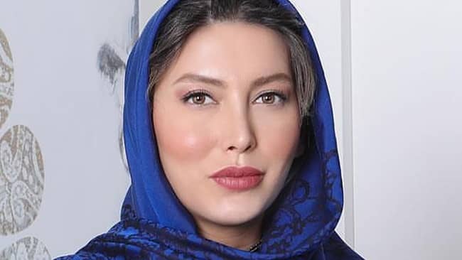 چهره جدید “فریبا نادری” پس از جراحی زیبایی / عکس