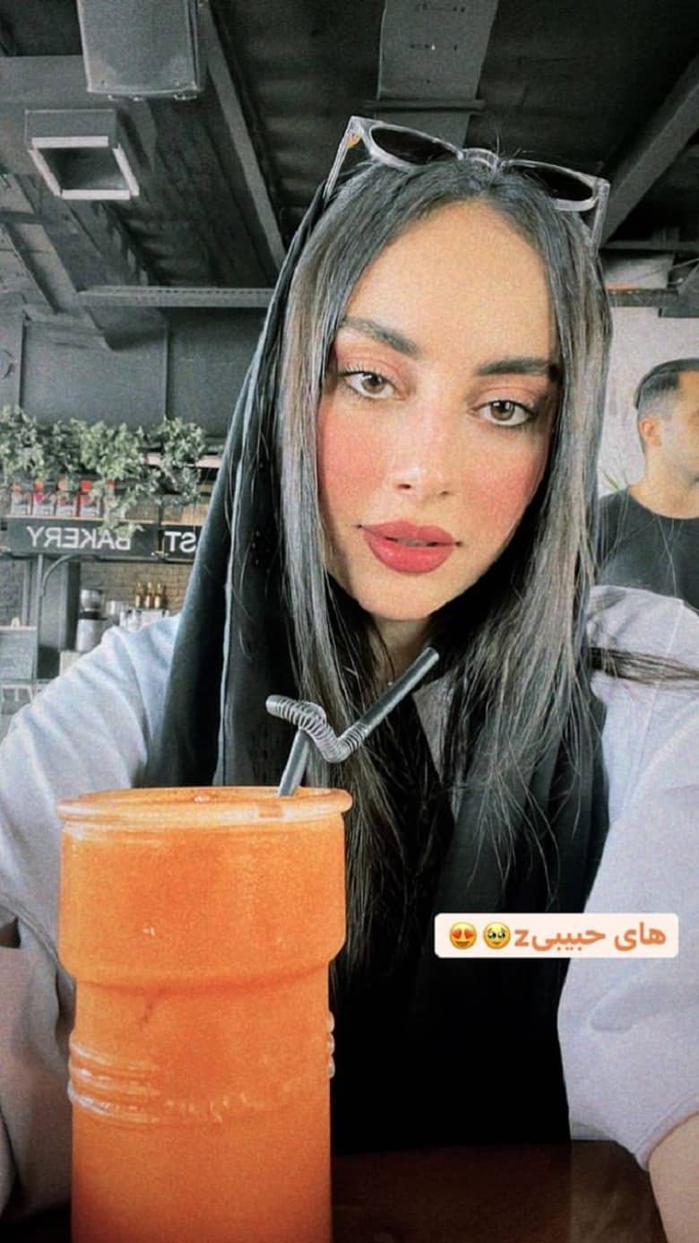 عکس/ دلیل چشمان خمار و غمگین ترلان پروانه چیست؟