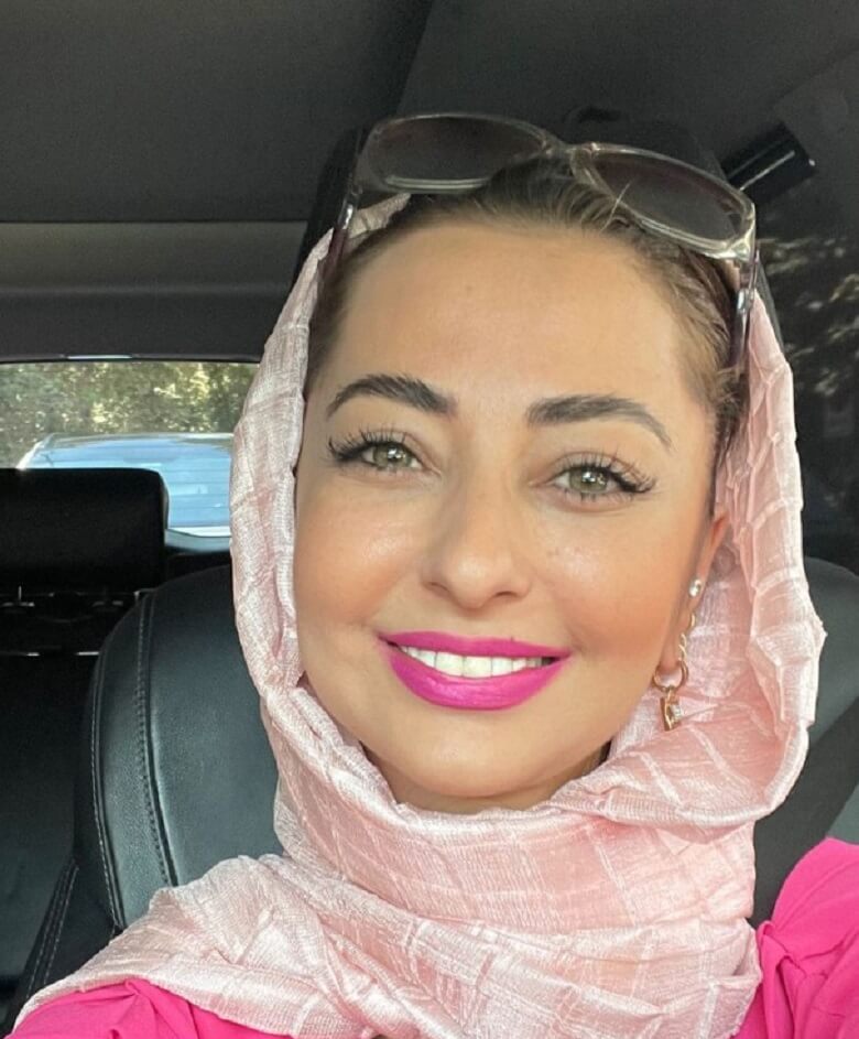 جوش‌های صورت نفیسه روشن خیلی واضح است.