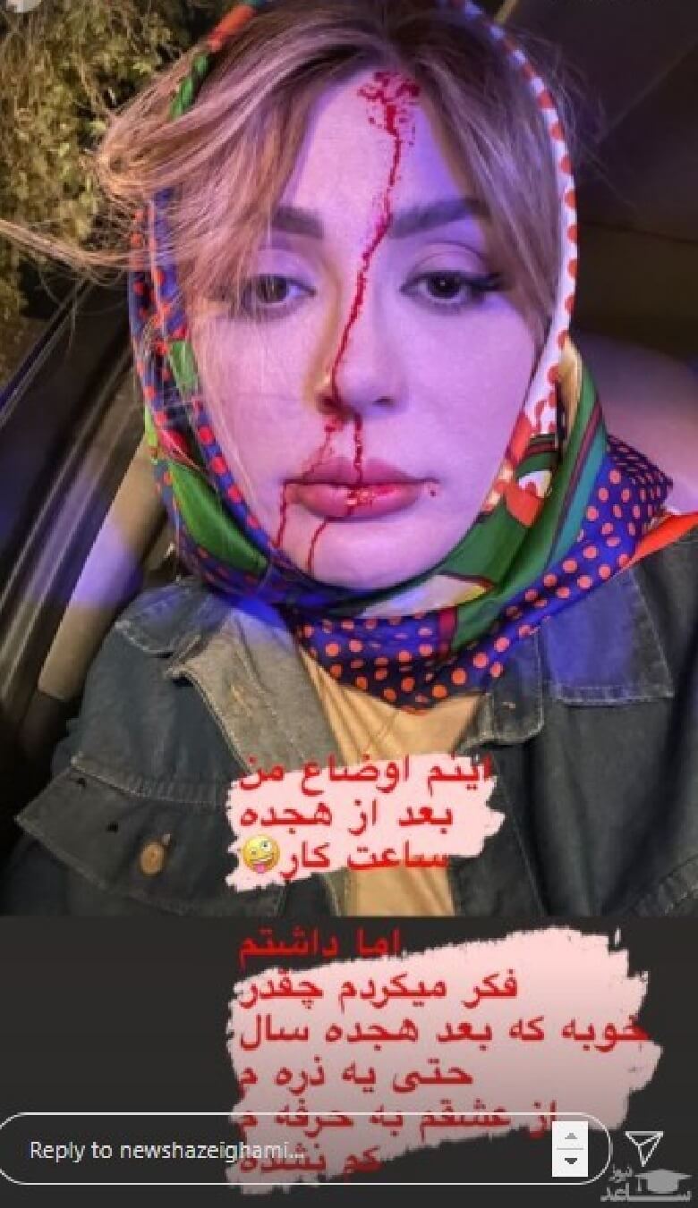 نیوشا ضیغمی با چهره خونی و زخمی‌ عکس گرفت.