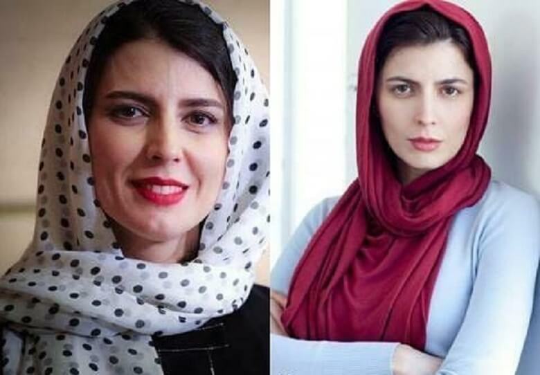 لیلا حاتمی عمل زیبایی نکرده است.