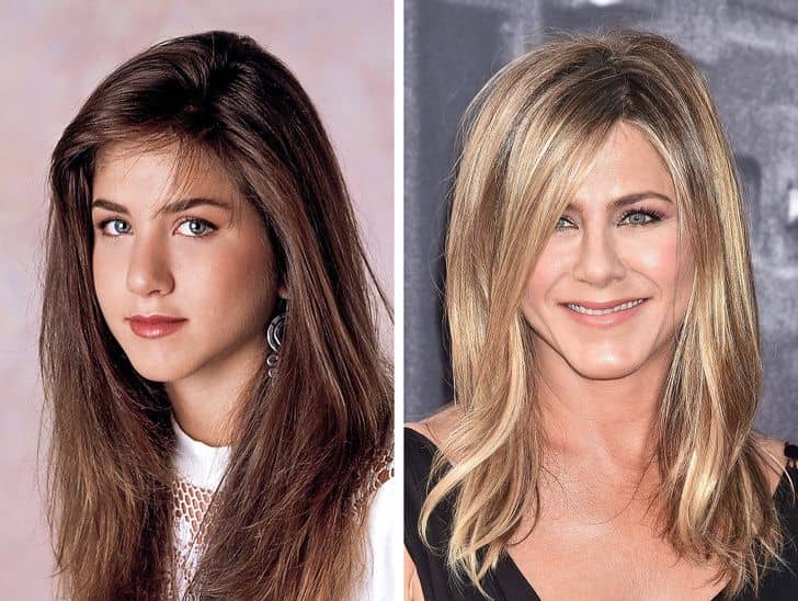 قبل و بعد عمل زیبایی جنیفر آنیستون