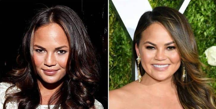 عمل زیبایی کریسی تیگن