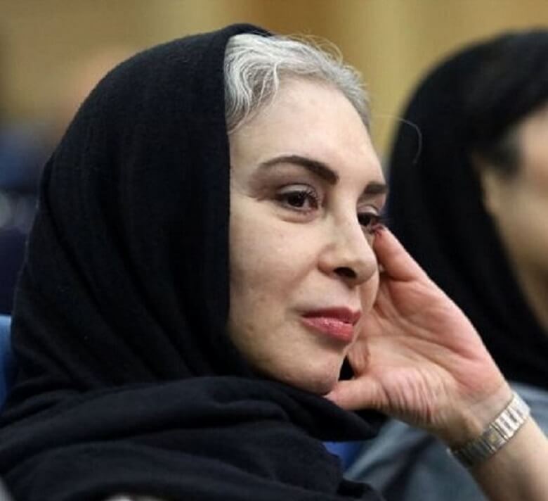 بر چهره دختر شایسته سابق ایران گرد پیری نشست.